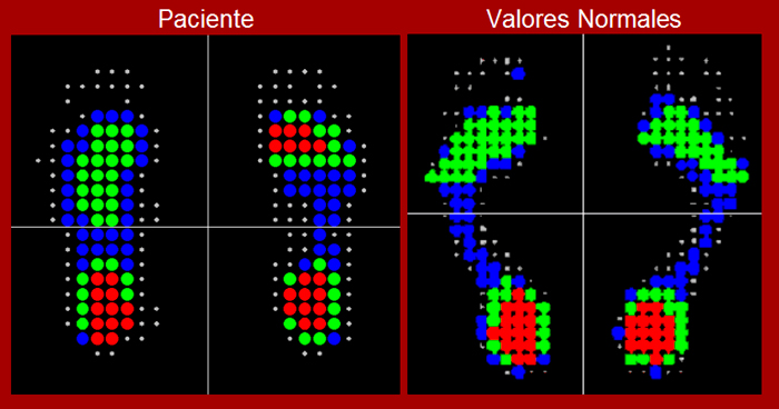 Plantillas Ortopedicas